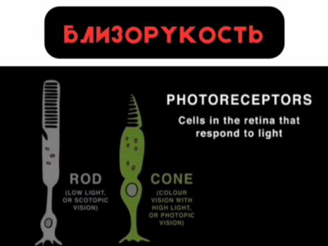[Артур Мазаев] Близорукость с точки зрения холисти_0.png